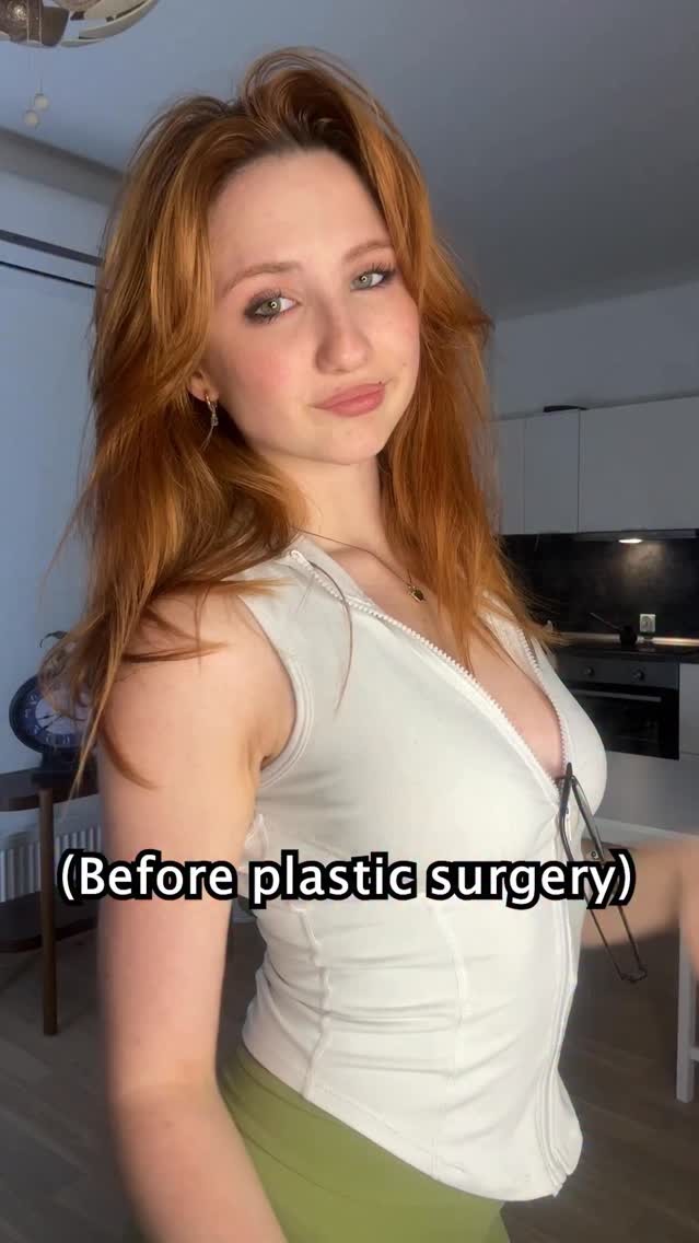 Do you want to see after?